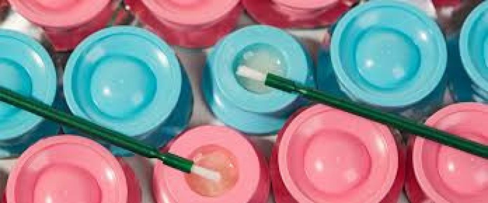 MI Varnish - Fluoride Varnishy